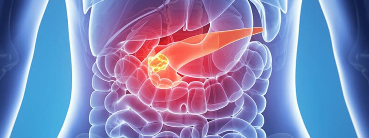 Вздулся живот - панкреатит у ворот: Врач рассказал, как предотвратить развитие смертельной болезни