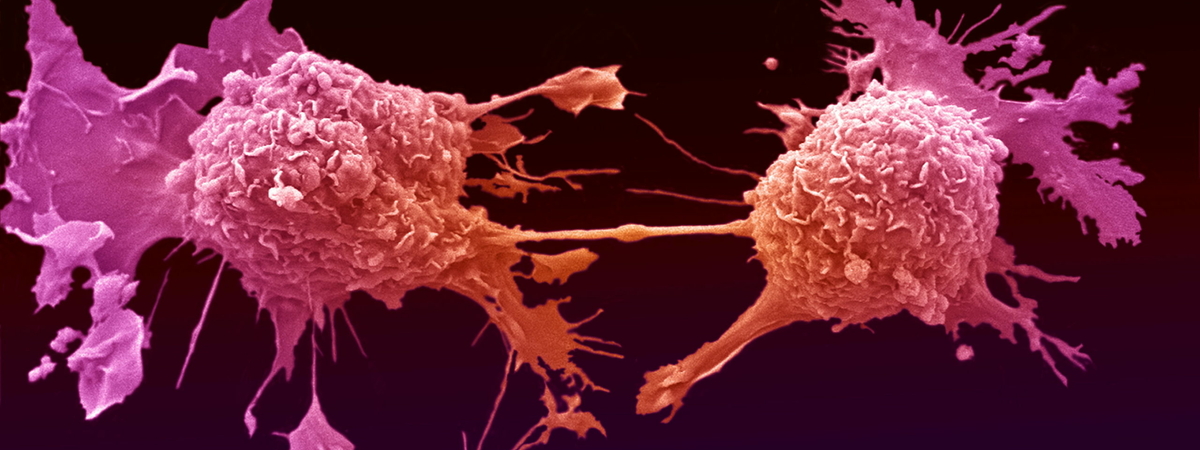 «Программа саморазрушения» или как человек создает раковые клетки