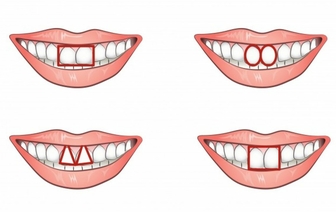 Как по форме зубов можно охарактеризовать человека