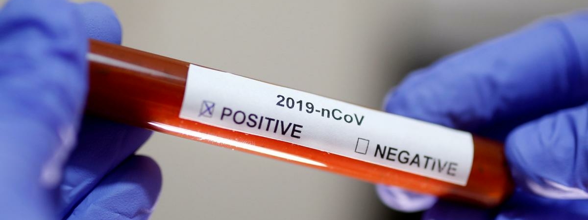 В Гродно можно сделать платный тест на коронавирус тем, кто выезжает за границу