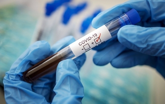 В Волковыске в райполиклинике будет проводиться бесплатное тестирование на антитела к COVID-19