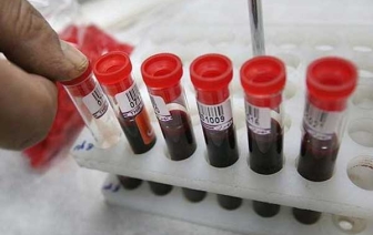 Россельхознадзор продолжает пугать россиян волковысскими сосисками