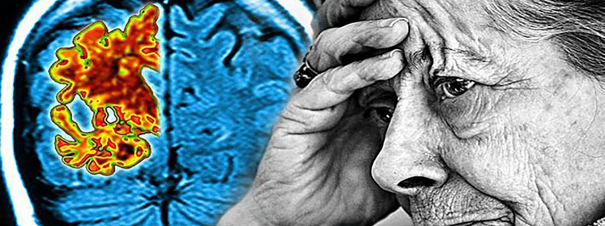 Болезнь Альцгеймера: как обезопасить себя