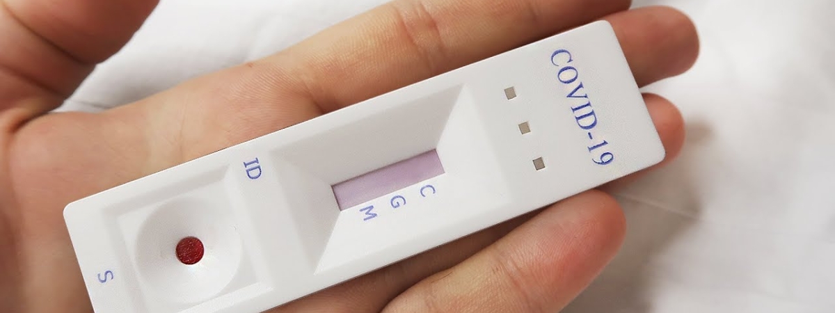 Белорусские экспресс-тесты на COVID-19 начали продавать в аптеках Волковыска