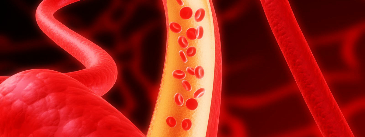 Как почистить кровеносные сосуды в домашних условиях?