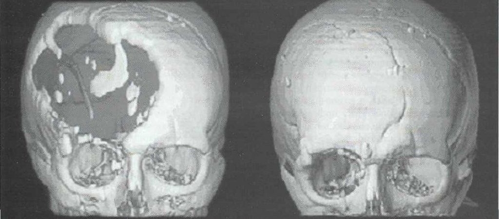 Сенсационное открытие ученых: сложнейшие операции проводили еще 2200 лет назад