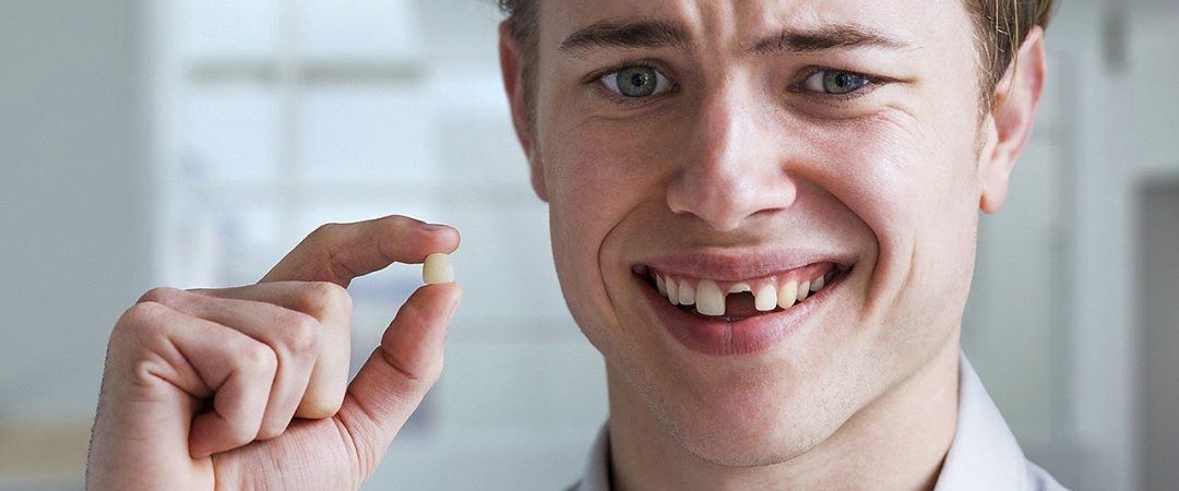 Потеря зубов: кто в зоне риска