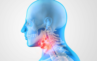 Онкологи предупреждают о симптомах рака головы и шеи