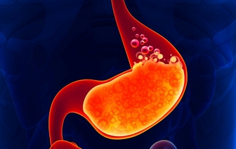 От изжоги можно избавиться без лекарств, нормализовав рацион - медики