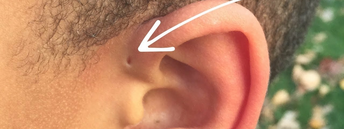 Что означают странные дырочки над ушами