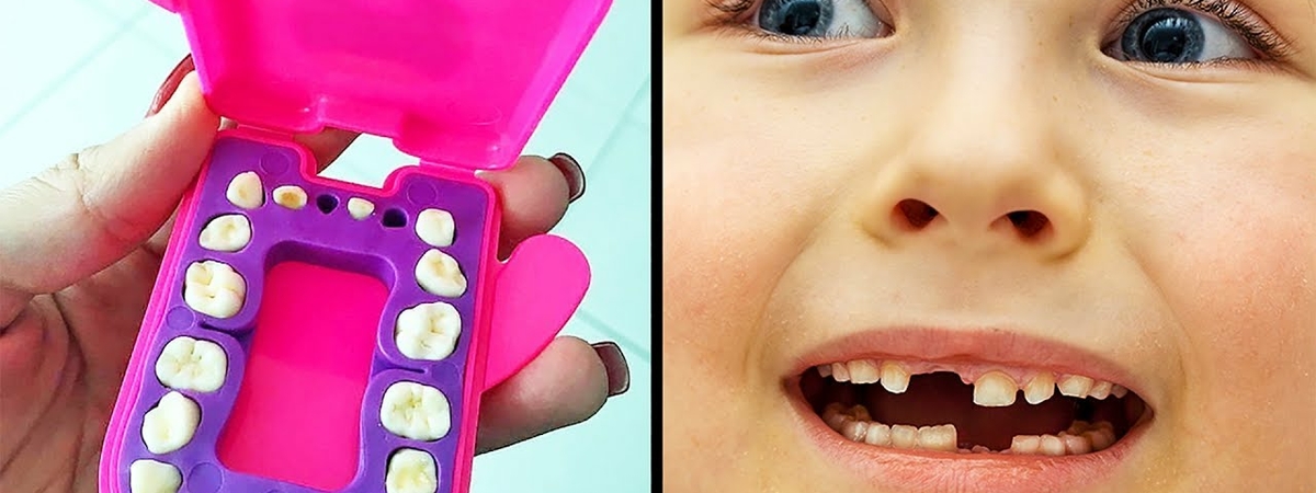 Почему врачи призывают родителей хранить молочные зубы детей