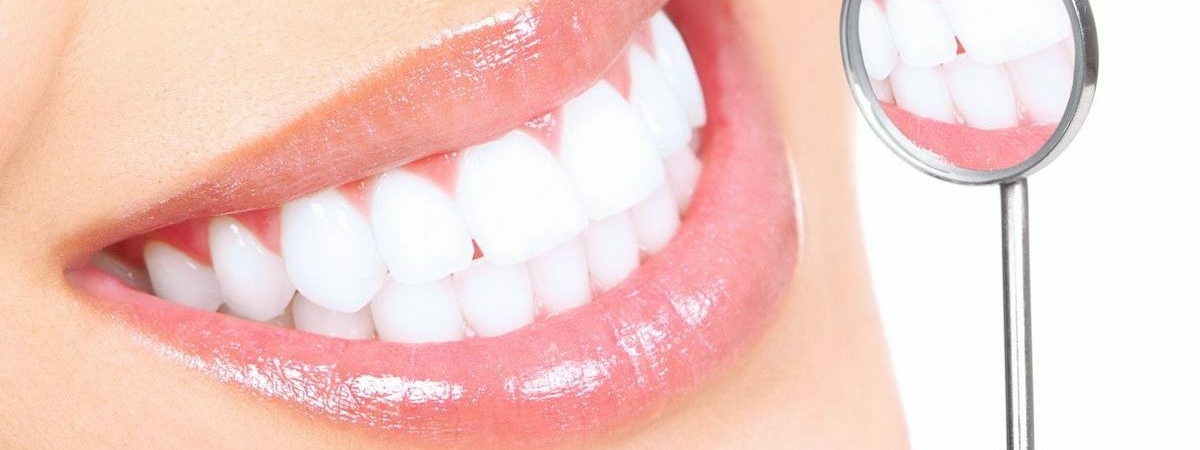 Стоматологи рассказали, как отбелить зубы в домашних условиях