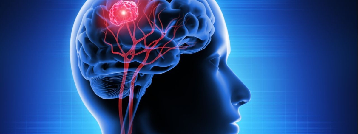 Обнаружен вирус «глупости», который снижает IQ на 9 пунктов и вызывает топографический кретинизм