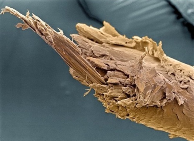 Как выглядит наше тело под микроскопом: 25 удивительных фотографий