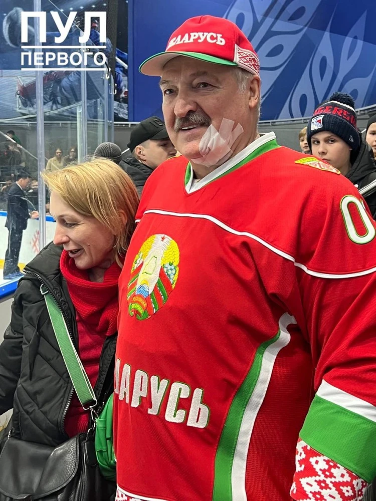 После травмы Лукашенко на лицо наклеили пластырь. Фото: телеграм-канал "Пул Первого"