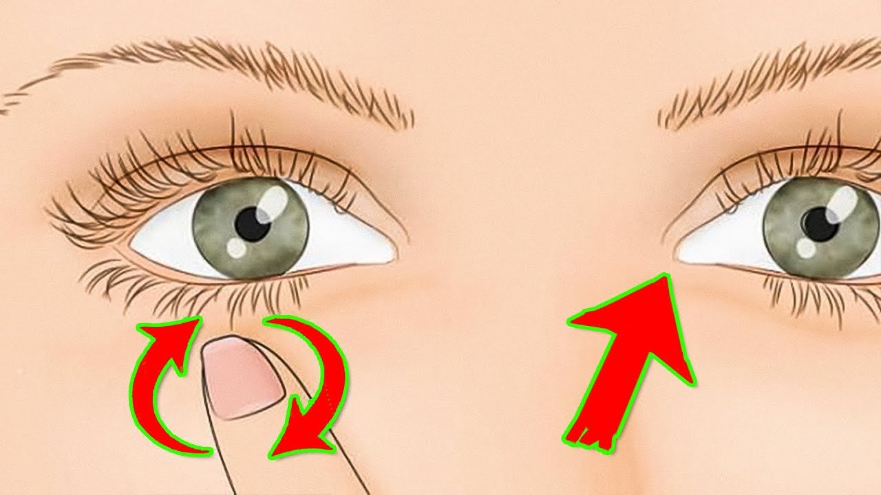 Дергается глаз: причины и как избавиться от нервного тика